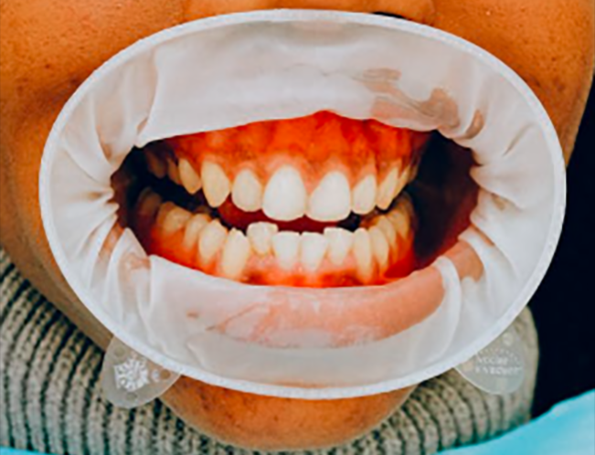 Ilustrasi/Foto:  Anna Shvets, pexels.com